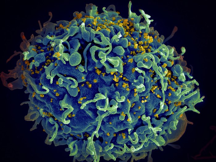 Iniciativas para acelerar la larga y difícil búsqueda de una vacuna contra el VIH 3
