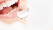 Las claves para asegurar el éxito de un blanqueamiento dental duradero
