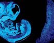 Los genes de la madre y del padre se ‘pelean’ por la nutrición del feto durante el embarazo