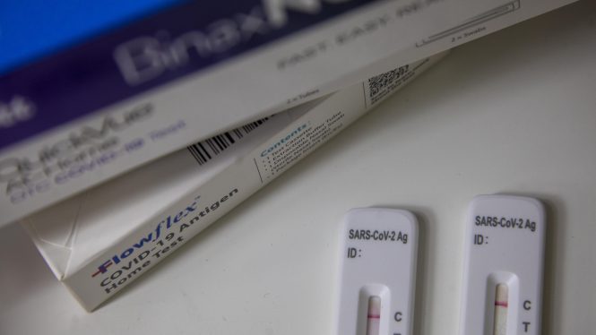 El Gobierno fijará este jueves un precio máximo de venta de los test de antígenos
