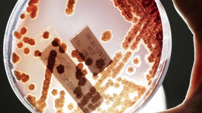 Las infecciones por bacterias multirresistentes causan más muertes que el sida o la malaria