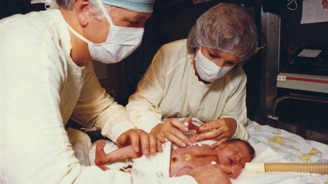 De la bebé con corazón de mono, a la mujer con hígado de cabra: la esperanza de los xenotrasplantes se reaviva