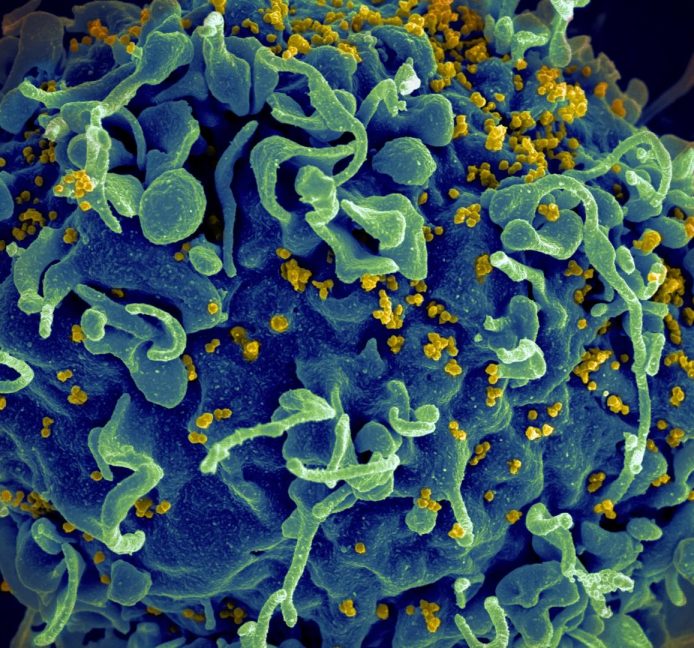 Descubierta una variante del VIH con mayor virulencia en los Países Bajos