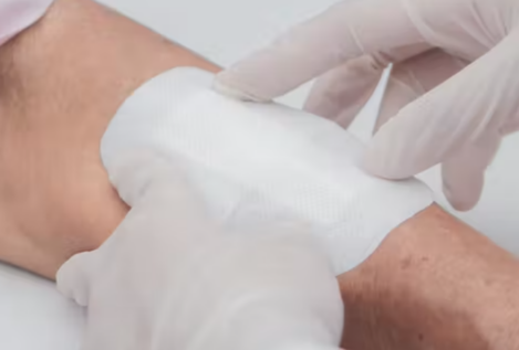 Nanomedicina para que las heridas recalcitrantes cicatricen