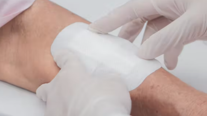 Nanomedicina para que las heridas recalcitrantes cicatricen