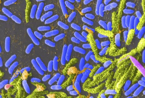 El Ministerio de Sanidad desmiente el caso de cólera detectado en Toledo: es gastroenteritis